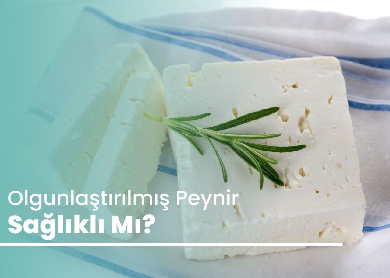 Olgunlaştırılmış Peynir Sağlıklı mı?